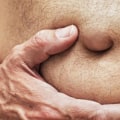 Understanding Abdominal Pain and Swelling